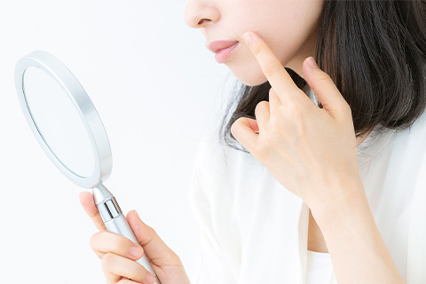美容鍼イメージ