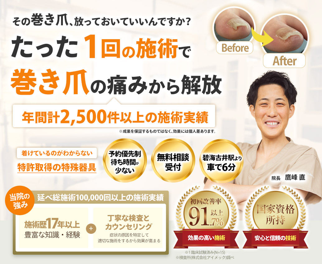 巻き爪ファーストビュー