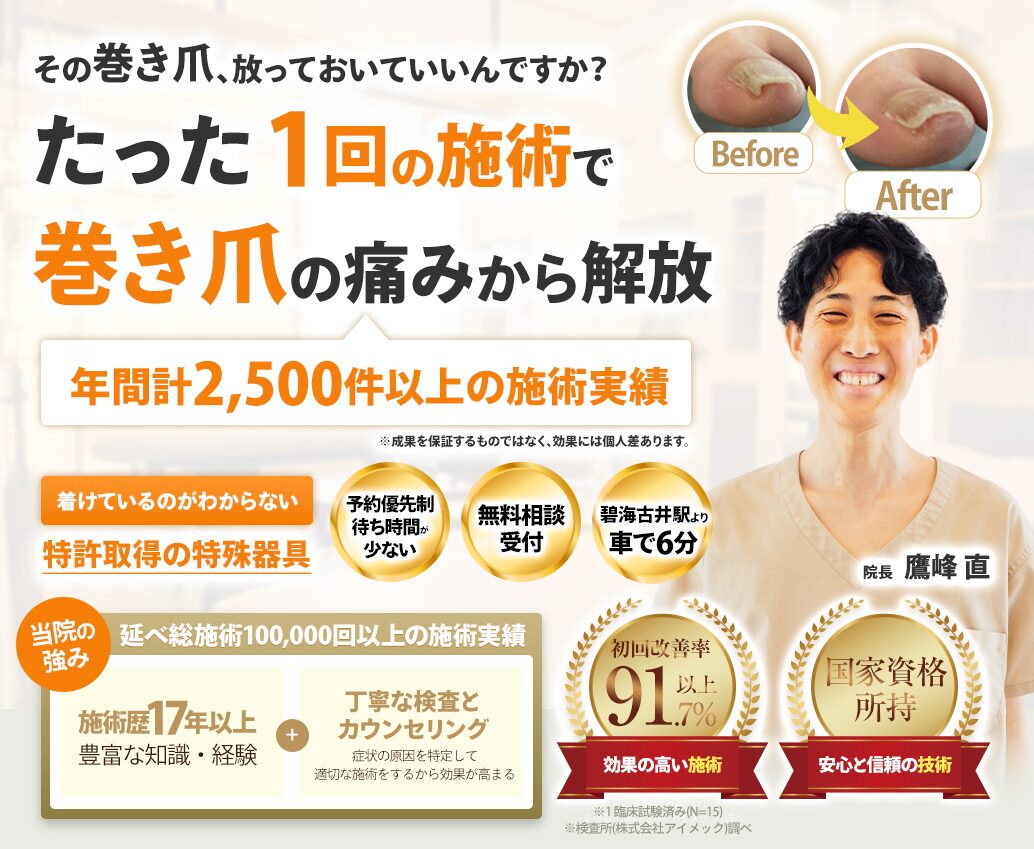 ファーストビュー巻き爪