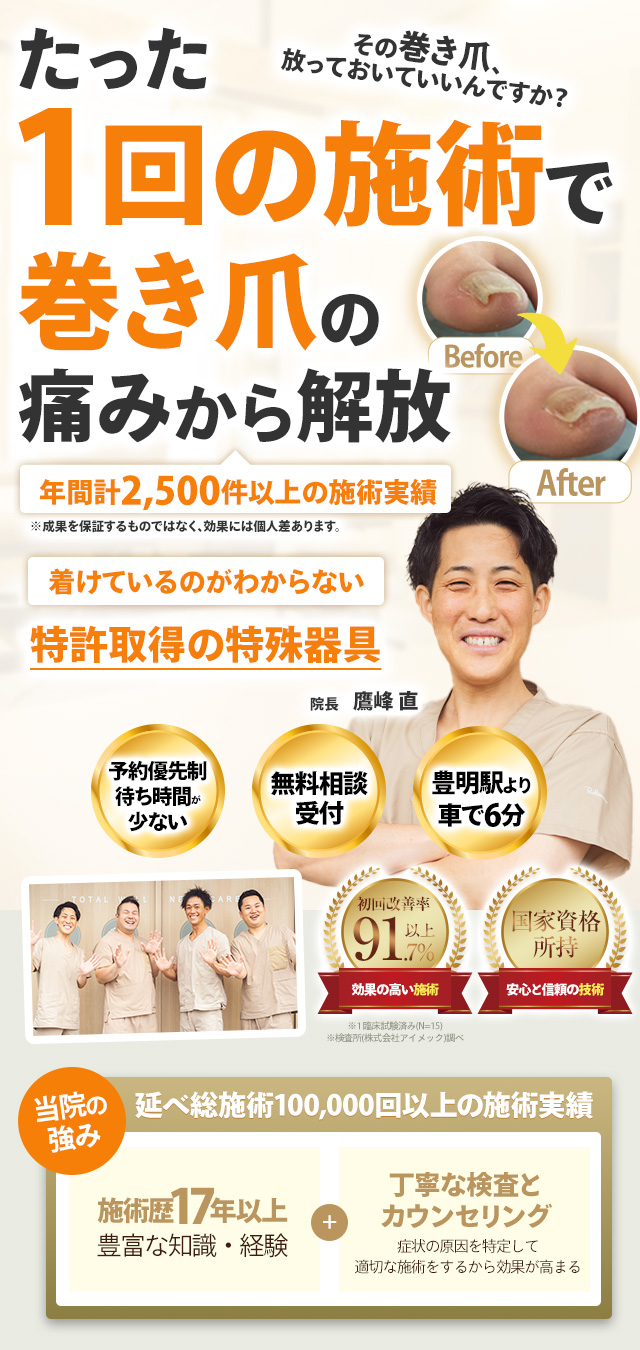巻き爪ファーストビュ―sp